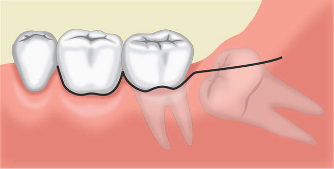 Surgery Effect treatment